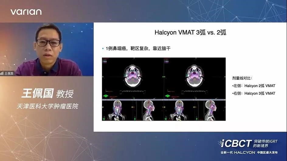 Halcyon_IGRT