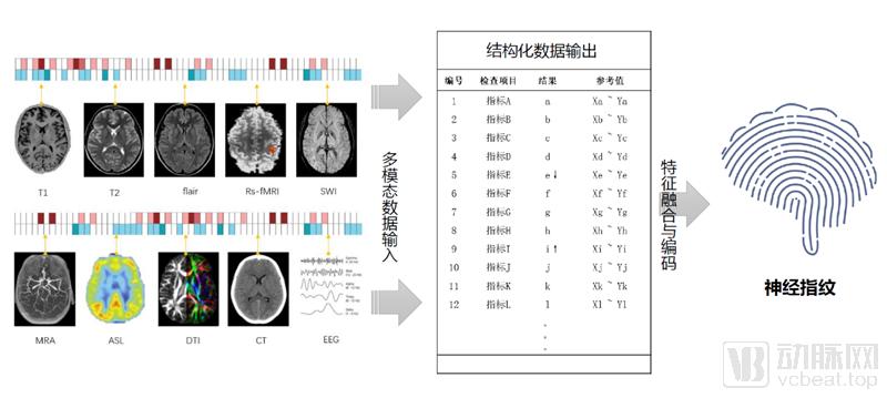 神经指纹技术_800.png