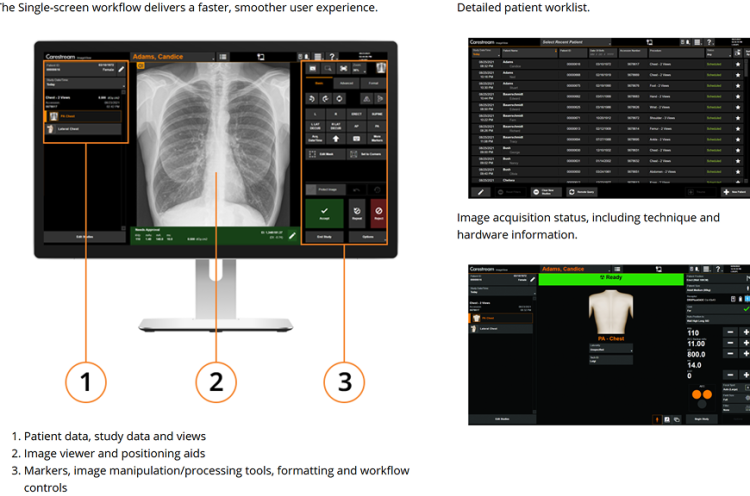 Carestream Imageview Software 